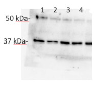 AOX2 | Plant alternative oxidase 2 in the group Antibodies Plant/Algal / Mitochondria | Respiration at Agrisera AB (Antibodies for research) (AS21 4532)